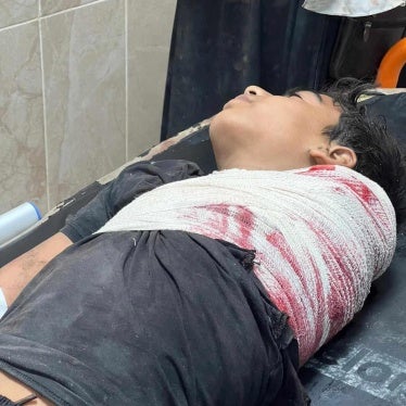 A boy with injuries/blood