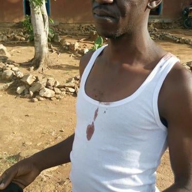 Standard newspaper journalist Isaiah Gwengi moments after being released by Kenya’s Quick Response Team police in Siaya, western Kenya, on March 23, 2017. The officers allegedly stripped, kicked and gun-butted him. 